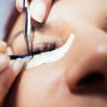 How long does eyelash extension allergy last?