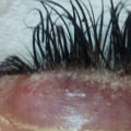 What happens to your eyelashes after extensions?