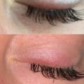 Can eyelash extension glue cause infection?