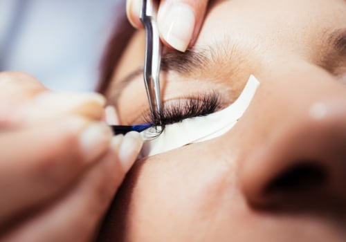 How long does eyelash extension allergy last?