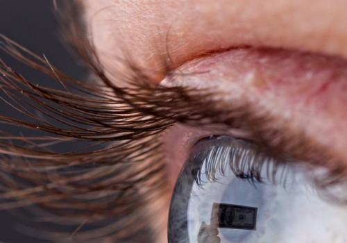 Can your eyelashes be too long?